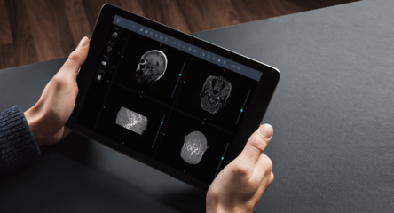 厚积薄发 汇医慧影CCR2019三大产品线升级，构建智慧影像全域生态